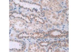 Used in DAB staining on fromalin fixed paraffin- embedded Kidney tissue (GAA Antikörper  (AA 70-225))