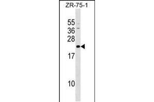 Western blot analysis in ZR-75-1 cell line lysates (35ug/lane). (GRPEL1 Antikörper  (AA 116-142))