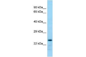 WB Suggested Anti-Rab17 Antibody Titration: 1.