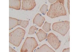 IHC-P analysis of Rat Tissue, with DAB staining. (TNNT1 Antikörper  (AA 1-228))