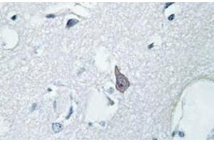Image no. 2 for anti-Opioid Receptor, mu 1 (OPRM1) antibody (ABIN317766)