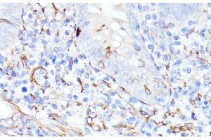 Immunohistochemistry (Paraffin-embedded Sections) (IHC (p)) image for anti-Coiled-Coil Domain Containing 6 (CCDC6) antibody (ABIN7258894)