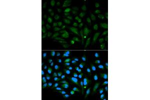 Immunofluorescence analysis of MCF-7 cells using DCN antibody (ABIN5970829). (Decorin Antikörper)