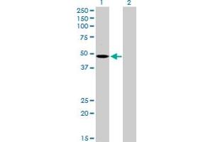 Western Blot analysis of MCHR1 expression in transfected 293T cell line by MCHR1 MaxPab polyclonal antibody. (MCHR1 Antikörper  (AA 1-422))