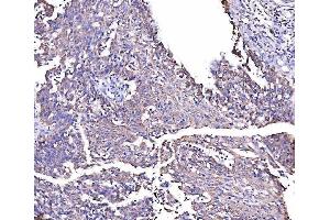 IHC analysis of MIRO1/RHOT1 using anti-MIRO1/RHOT1 antibody (ABIN7602209).