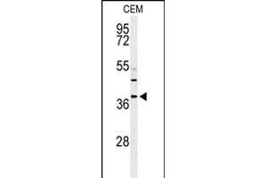 Western blot analysis of RNASEH2B Antibody (Center) (ABIN650970 and ABIN2840016) in CEM cell line lysates (35 μg/lane). (RNASEH2B Antikörper  (AA 130-157))