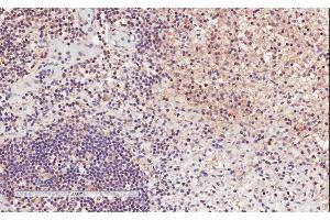 ABIN571017 (2µg/ml) staining of paraffin embedded Human Lymph Node. (ITGAL Antikörper  (Internal Region))