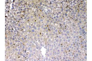 PSAT1 was detected in paraffin-embedded sections of mouse liver tissues using rabbit anti- PSAT1 Antigen Affinity purified polyclonal antibody (Catalog # ) at 1 ? (PSAT1 Antikörper  (AA 276-370))