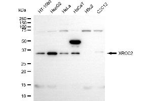 Western blotting analysis using XRCC2 antibody (ABIN7800875).