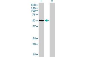 Western Blot analysis of CAMK2D expression in transfected 293T cell line by CAMK2D monoclonal antibody (M02), clone 1A8.