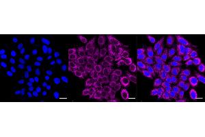 Immunocytochemical staining of HepG2 cells with cytochrome P450 17A1/CYP17A1 antibody (ABIN7798251), 1:1,000).