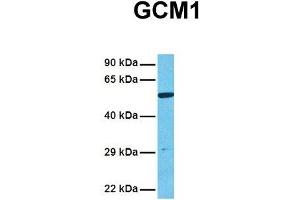 Western Blotting (WB) image for anti-Glial Cells Missing Homolog 1 (GCM1) (N-Term) antibody (ABIN2792608)