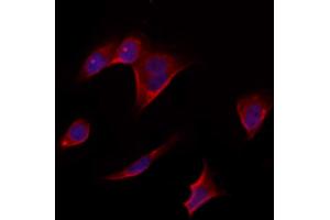 ABIN6264846 and ABIN6273312 staining Hela by IF/ICC. (RPS14 Antikörper  (Internal Region))