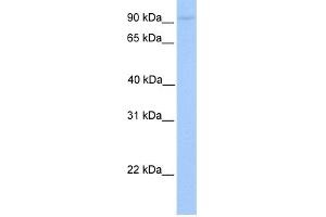 WB Suggested Anti-AGBL5 Antibody Titration: 0. (AGBL5 Antikörper  (C-Term))