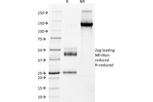 SDS-PAGE Analysis Purified NKX2.