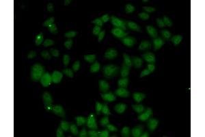 Immunofluorescence analysis of U2OS cells using FGF14 antibody (ABIN5973959). (FGF14 Antikörper)