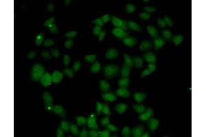 Immunofluorescence analysis of U2OS cells using FGF14 antibody (ABIN5973959).