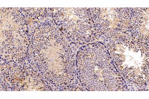 Detection of C3 Convertase in Mouse Testis Tissue using Polyclonal Antibody to Complement C3 Convertase (C3 Convertase) (Complement C3 Convertase Antikörper)