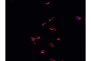 ABIN6268891 staining LOVO cells by IF/ICC. (FAP Antikörper  (Internal Region))