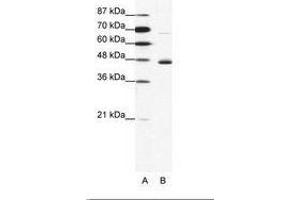 Image no. 1 for anti-Neuronal Differentiation 1 (NEUROD1) (N-Term) antibody (ABIN202333) (NEUROD1 Antikörper  (N-Term))
