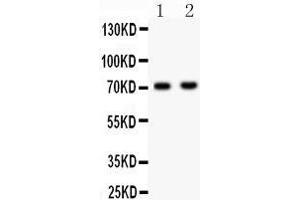 Anti- NUMB Picoband antibody, Western blotting All lanes: Anti NUMB  at 0. (NUMB Antikörper  (N-Term))