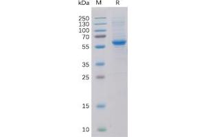 Human ROR2 Protein, His Tag on SDS-PAGE under reducing condition.