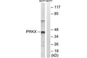 Western blot analysis of extracts from MCF-7 cells, using PRKX Antibody. (PRKX Antikörper  (AA 251-300))