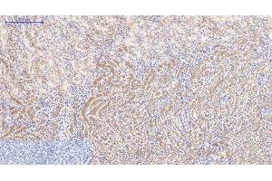 Immunohistochemistry of paraffin-embedded Mouse kidney tissue using Catenin beta Monoclonal Antibody at dilution of 1:200. (beta Catenin Antikörper)