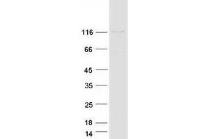 PHKA1 Protein (Transcript Variant 1) (Myc-DYKDDDDK Tag)