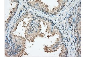 Immunohistochemical staining of paraffin-embedded Human prostate tissue using anti-PRKAR2A mouse monoclonal antibody.
