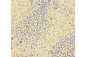 Immunohistochemistry of paraffin-embedded human tonsil tissue using ABIN7172118 at dilution of 1:100