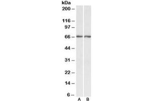 Western blot testing of human A) cerebellum and B) hippocampus lysate with Acetylcholinesterase antibody at 0. (Acetylcholinesterase Antikörper)