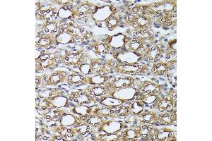 Immunohistochemistry of paraffin-embedded mouse kidney using D antibody (ABIN7266712) at dilution of 1:100 (40x lens). (DAPK3 Antikörper  (AA 1-100))