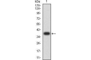 Western blot analysis using HLA-B mAb against human HLA-B (AA: 241-362) recombinant protein. (HLA-B Antikörper  (AA 241-362))