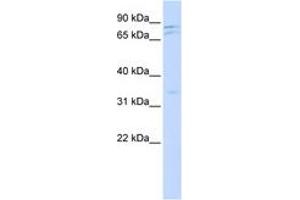 Image no. 1 for anti-NIMA (Never In Mitosis Gene A)-Related Kinase 11 (NEK11) (AA 504-553) antibody (ABIN6743500) (NEK11 Antikörper  (AA 504-553))