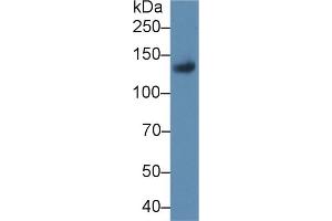 Detection of LIFR in Rat Placenta lysate using Polyclonal Antibody to Leukemia Inhibitory Factor Receptor (LIFR) (LIFR Antikörper  (AA 642-791))