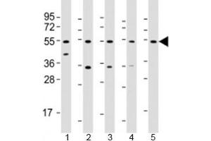 Western blot testing of human 1) liver, 2) HeLa, 3) PC-3, 4) SK-BR-3 and 5) TT cell lysate with THRB antibody at 1:2000. (THRB Antikörper  (AA 23-55))