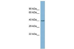 CK1 gamma 2 antibody used at 1 ug/ml to detect target protein. (Casein Kinase 1 gamma 2 Antikörper  (Middle Region))