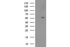 HEK293T cells were transfected with the pCMV6-ENTRY control (Left lane) or pCMV6-ENTRY TP53 (Right lane) cDNA for 48 hrs and lysed. (p53 Antikörper)