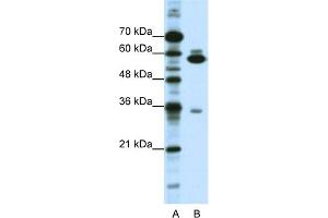 WB Suggested Anti-ZNF446 Antibody Titration:  1.