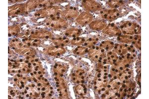 Immunohistochemistry (IHC) image for anti-Adenosine Kinase (ADK) antibody (ABIN2855027)