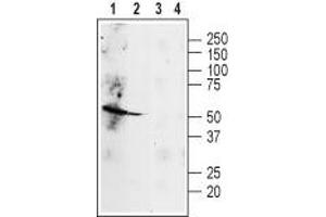 Western blot analysis of rat heart (lanes 1 and 3) and lung (lanes 2 and 4) lysates: - 1,3. (beta 2 Adrenergic Receptor Antikörper  (Extracellular, N-Term))