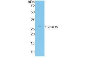 Detection of Recombinant RIG1, Mouse using Polyclonal Antibody to Probable ATP-dependent RNA Helicase DDX58 (DDX58)