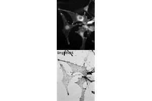 Image no. 1 for anti-Melanophilin (MLPH) (C-Term) antibody (ABIN374219) (Melanophilin Antikörper  (C-Term))