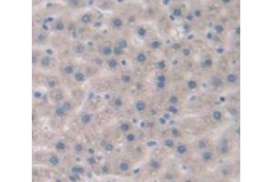 IHC-P analysis of Rat Tissue, with DAB staining. (IL-6 Receptor Antikörper  (AA 214-348))