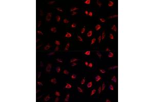 Immunofluorescence analysis of L929 cells using NEDD1 antibody (ABIN1681008, ABIN3019378, ABIN3019379 and ABIN6220853) at dilution of 1:100. (NEDD1 Antikörper  (AA 411-660))
