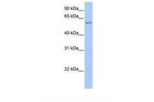 Image no. 1 for anti-Deoxynucleotidyltransferase, terminal (DNTT) (AA 32-81) antibody (ABIN6738803) (TdT Antikörper  (AA 32-81))