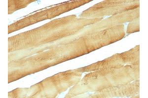 Formalin-fixed, paraffin-embedded Rat Skeletal Muscle stained with Muscle Specific Actin Mouse Monoclonal Antibody (MSA/953). (ACTA1/ACTA2A/ACTG2 Antikörper)