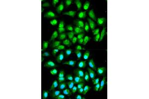 Immunofluorescence analysis of HeLa cells using RAN antibody. (RAN Antikörper)