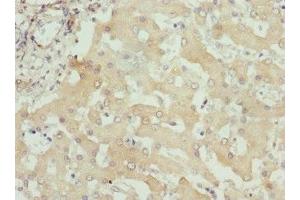 Immunohistochemistry of paraffin-embedded human liver tissue using ABIN7156320 at dilution of 1:100 (ITPK1 Antikörper  (AA 185-414))